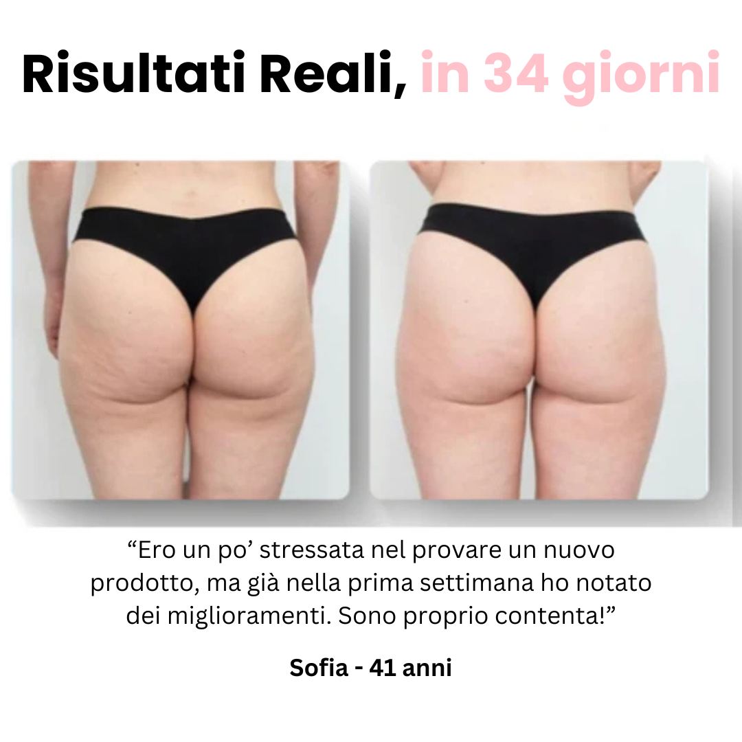 Velora™ - Massaggiatore Anti Cellulite